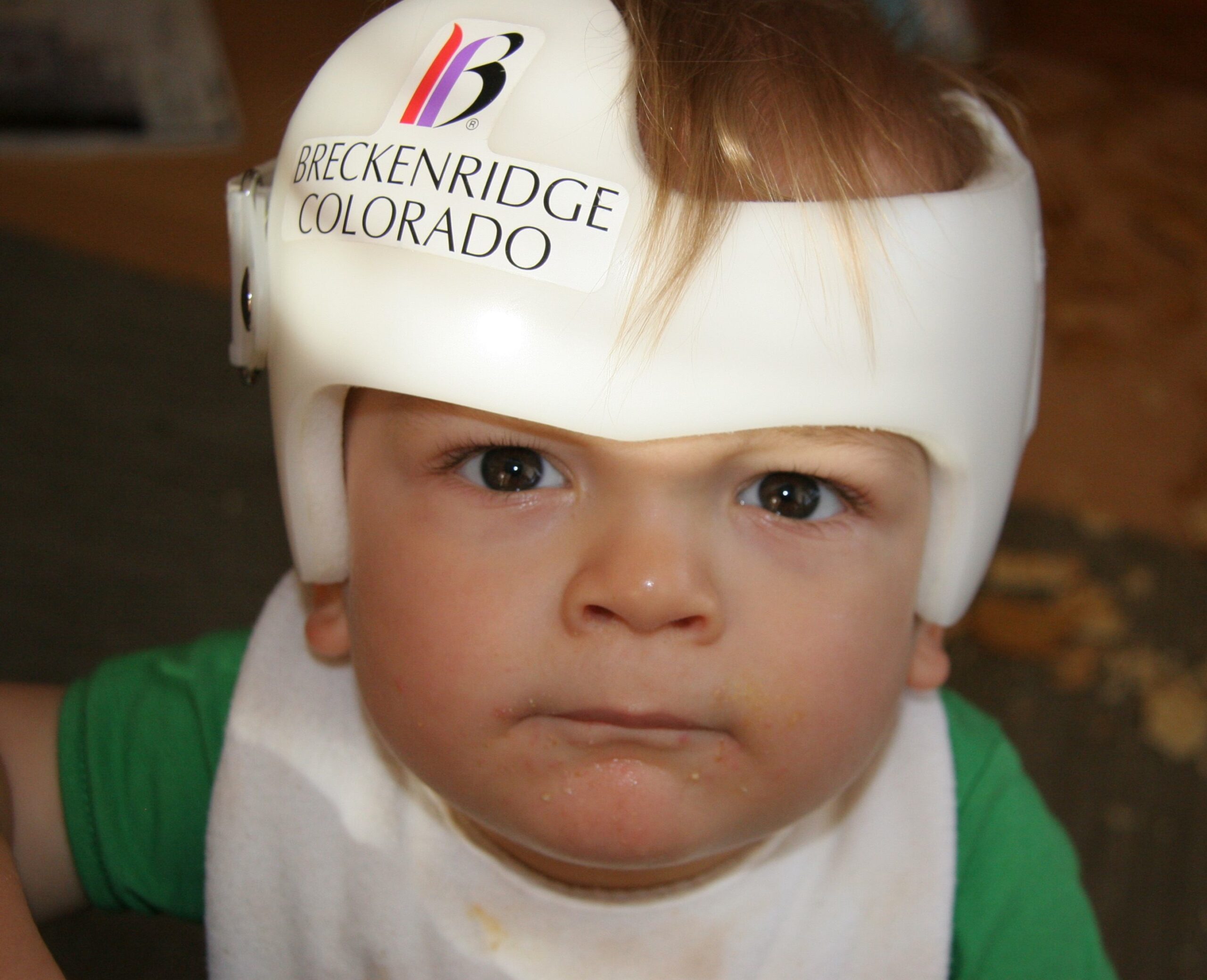 Is the Head Round? Baby helmets may help “Flat Head Syndrome”